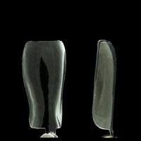 Anterior Matrix A103