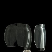 Anterior Matrix A104