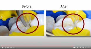 Bioclear Matrix